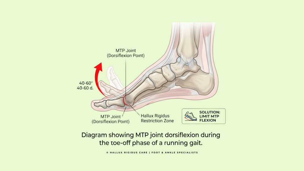 Diagram of MTP joint dorsiflexion during the toe-off phase of a running gait.