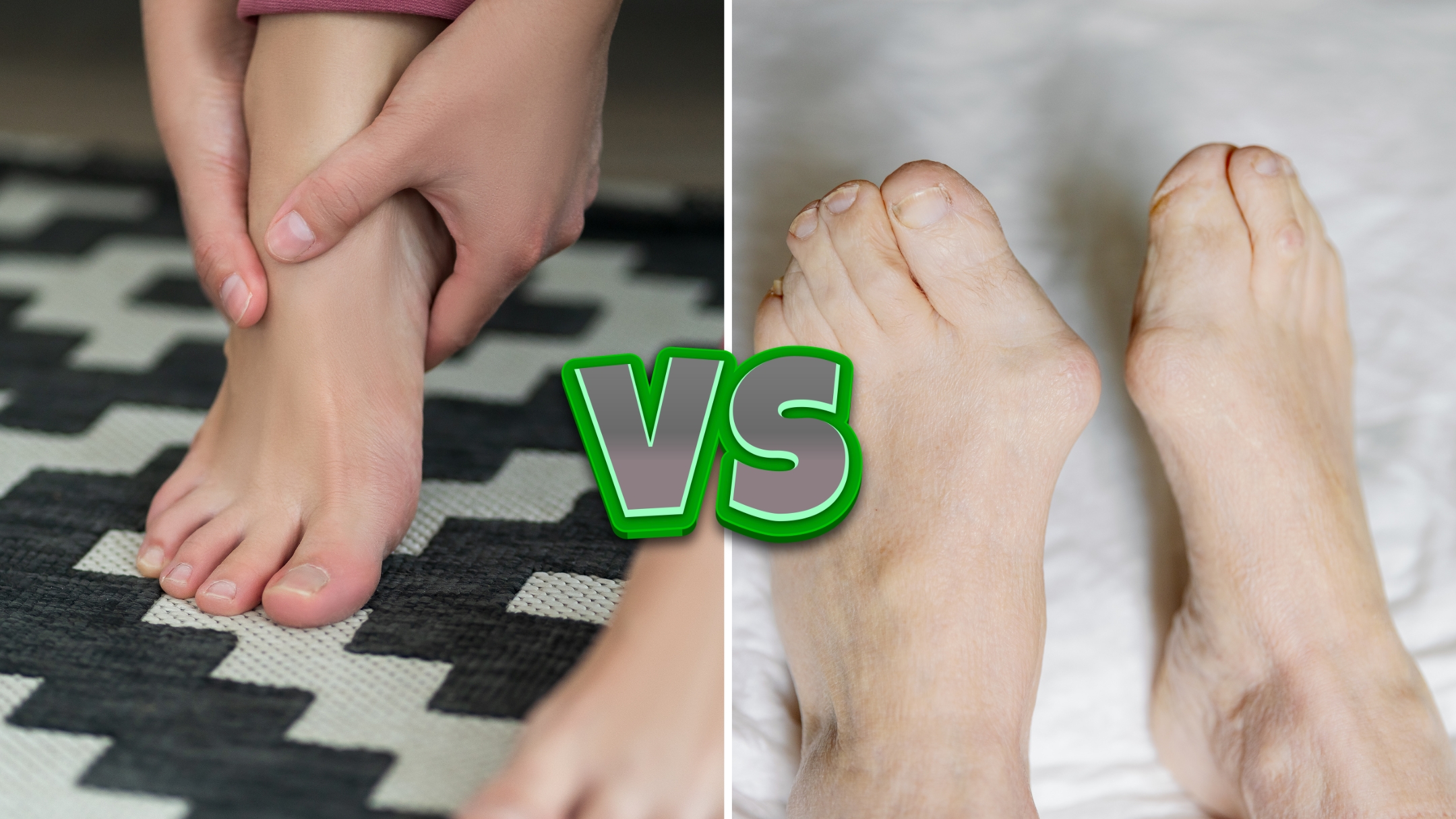 Comprehensive clinical comparison of Hallux Limitus vs. Hallux Rigidus stages, featuring diagnostic X-rays and big toe joint mobility angles.